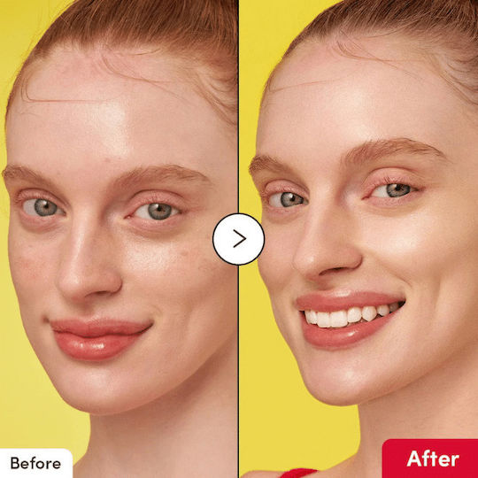 Eqqualberry Vitamin Illuminating Serum Προσώπου με Βιταμίνη C & Νιασιναμίδη για Πανάδες & Ατέλειες 30ml