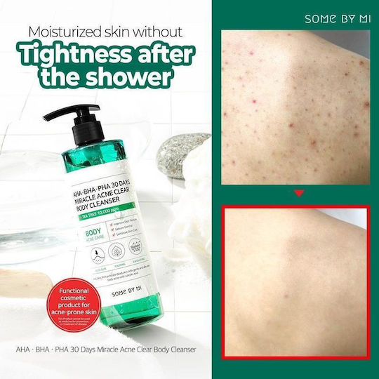 Some By Mi 30 DAYS MIRACLE Gel για το Σώμα 400gr