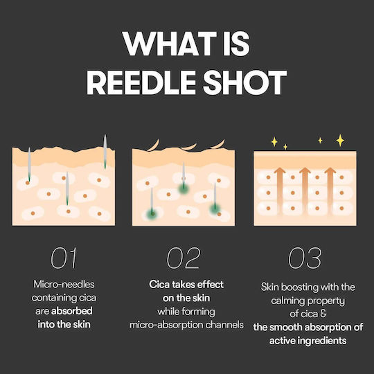 Vt Cosmetics Reedle Shot 300 50ml Εντατικός Ενισχυτής Ενδυνάμωσης