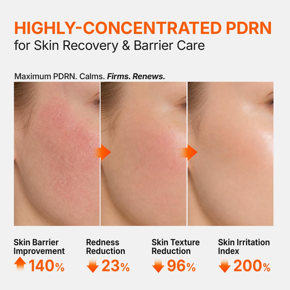 PDRN 3% Hyper Boost Ampoule -  Αμπούλα Υψηλής Συγκέντρωσης PDRN για Εντατική Ανάπλαση, Ενυδάτωση & Ενίσχυση του Δερματικού Φραγμού 40ml