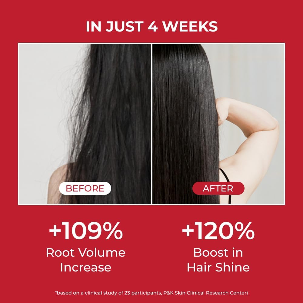 Annurcatin Shampoo – Σαμπουάν Ενδυνάμωσης & Όγκου για Αδύναμα Μαλλιά 525ml
