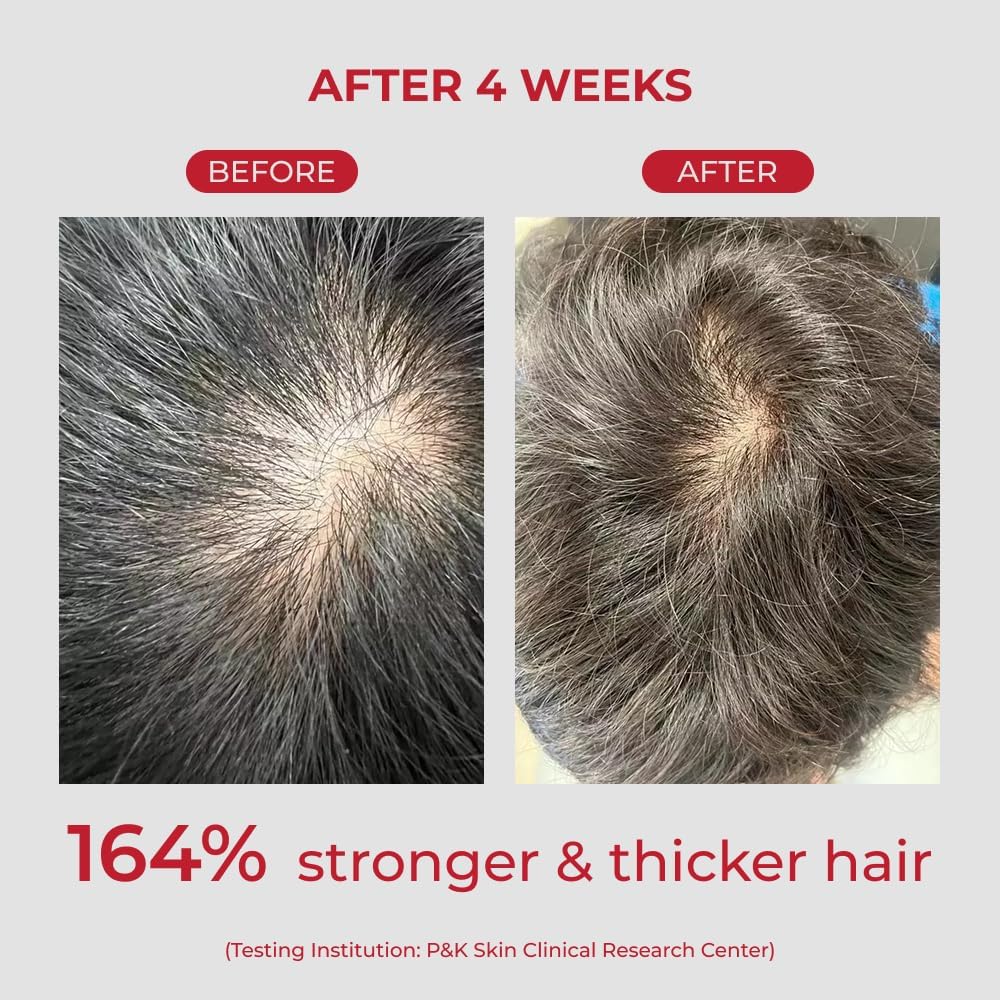 Annurcatin Shampoo – Σαμπουάν Ενδυνάμωσης & Όγκου για Αδύναμα Μαλλιά 525ml