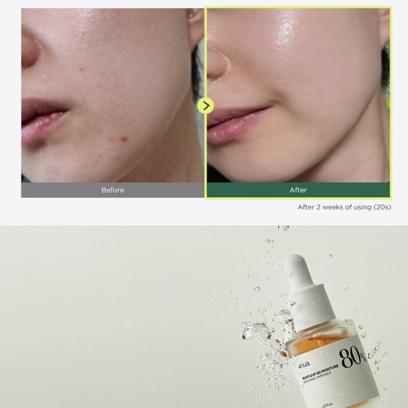 Anua Heartleaf 80% Soothing Ampoule Αντιγηραντικό Essence Προσώπου με Υαλουρονικό Οξύ & Βιταμίνη B5 30ml