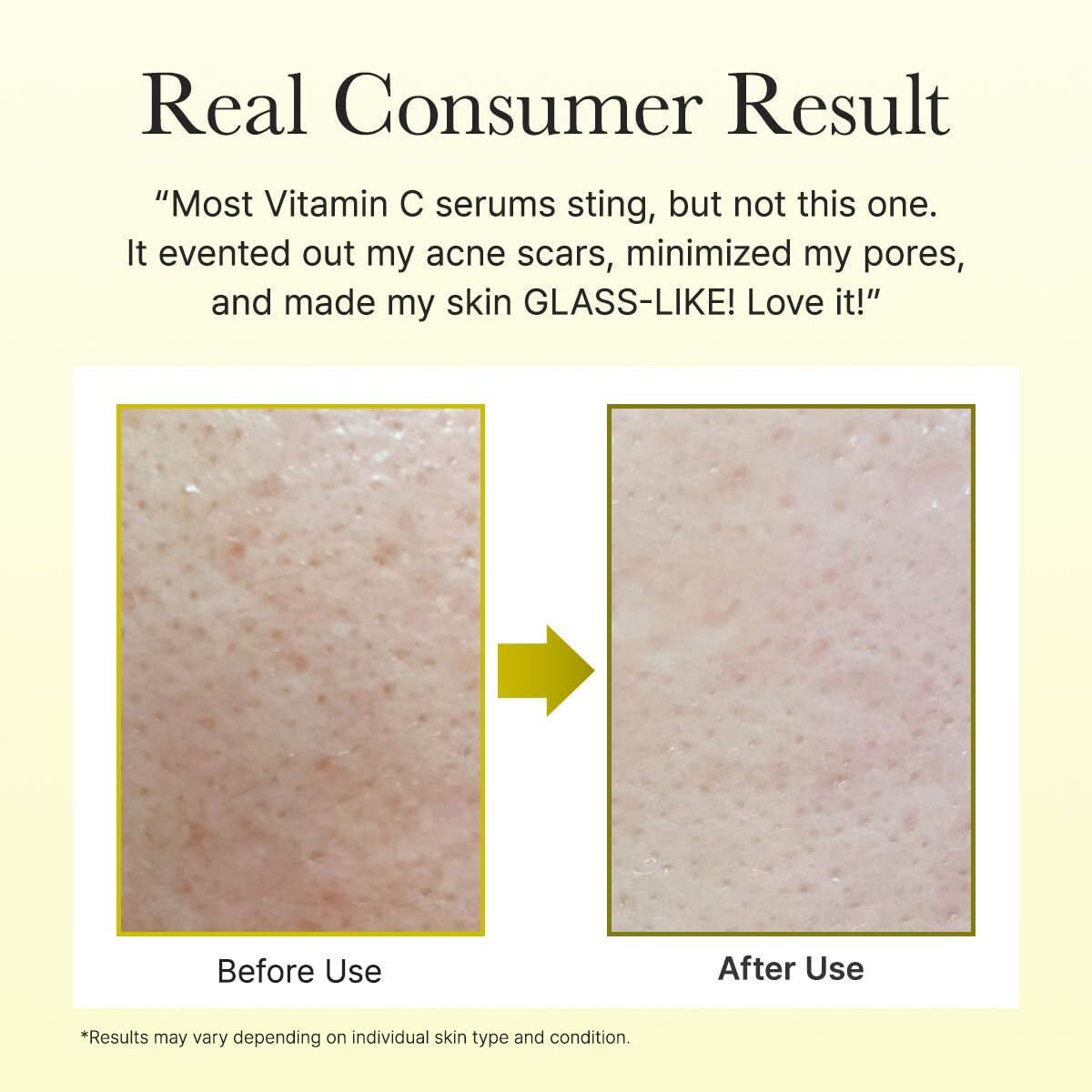 Arencia Vitamin C Booster Προσώπου με Βιταμίνη C για Αποτοξίνωση & Λάμψη 30ml