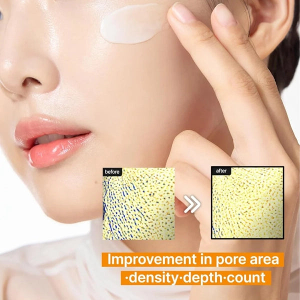 Celimax Pore + Dark Spot Κρέμα Προσώπου για Πανάδες & Λεύκανση με Νιασιναμίδη 35ml