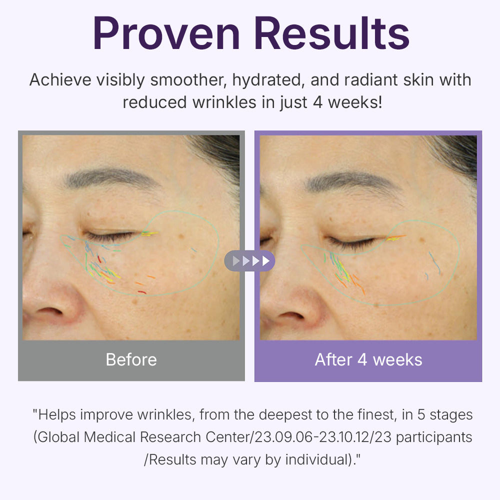 Centellian24 360º Shot PDRN Active Ενυδατικό & Αντιγηραντικό Serum Ματιών με Υαλουρονικό Οξύ για Σύσφιξη & Αναζωογόνηση 50ml