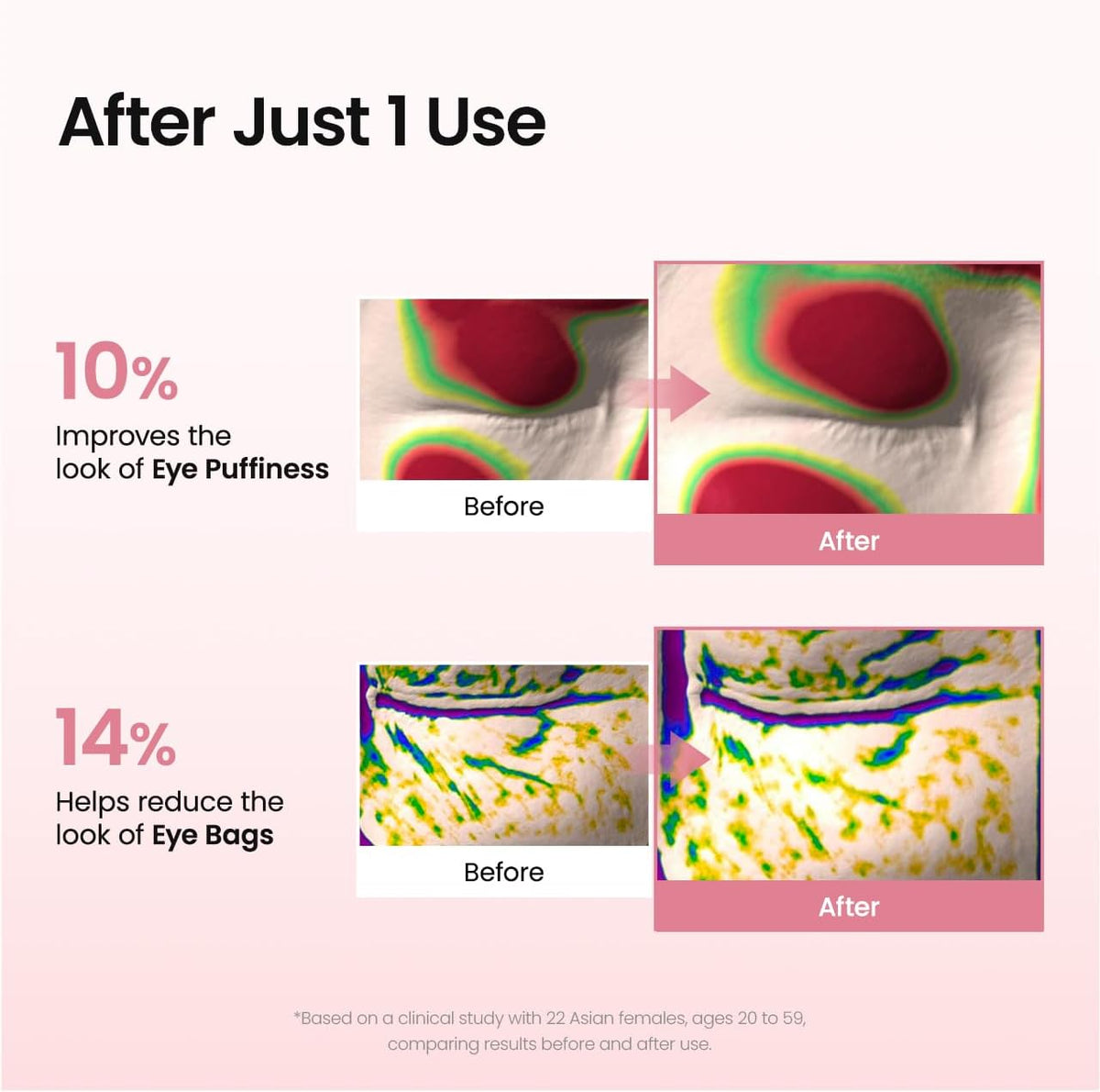 Collagen Eye Patches – Patches Ματιών με Κολλαγόνο, Πεπτίδια & Καφεΐνη 30τμχ