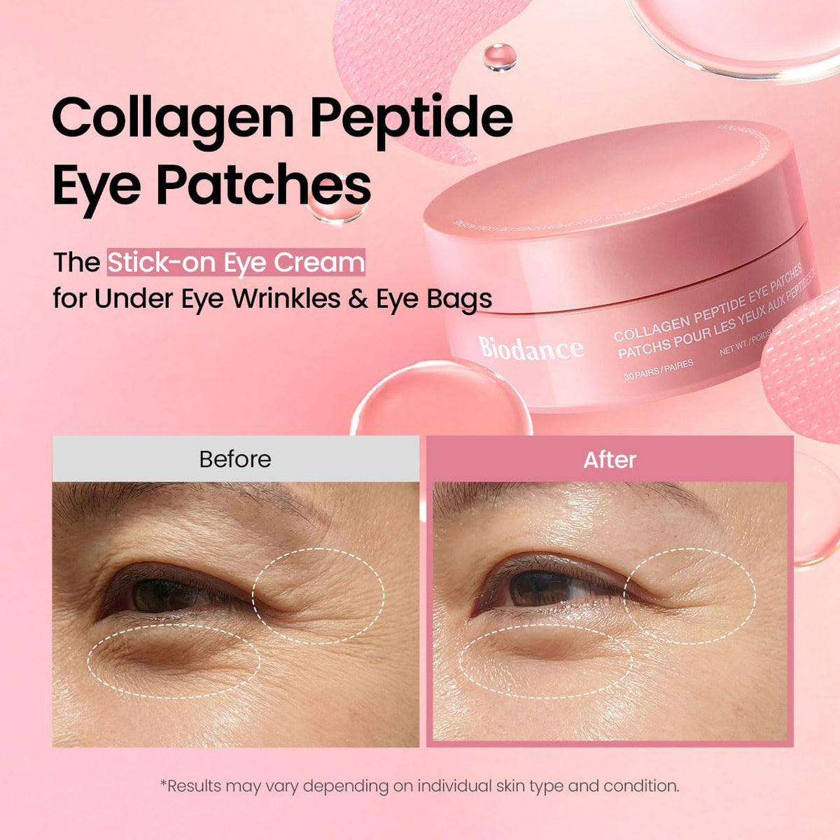 Collagen Eye Patches – Patches Ματιών με Κολλαγόνο, Πεπτίδια & Καφεΐνη 30τμχ