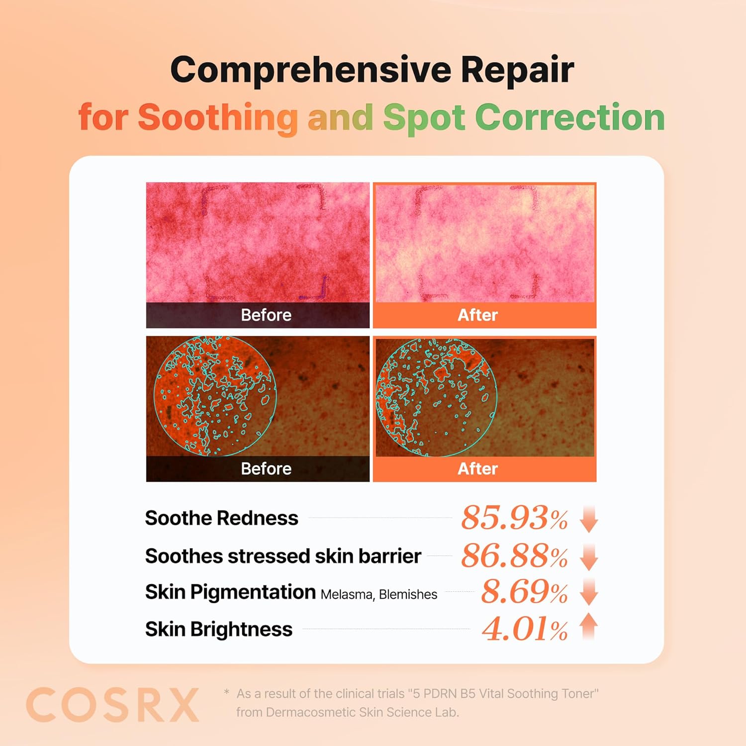 Cosrx 5 PDRN B5 Vital Soothing Toner - Αναζωογονητικό Toner για Λάμψη, Σύσφιξη & Καταπράυνση