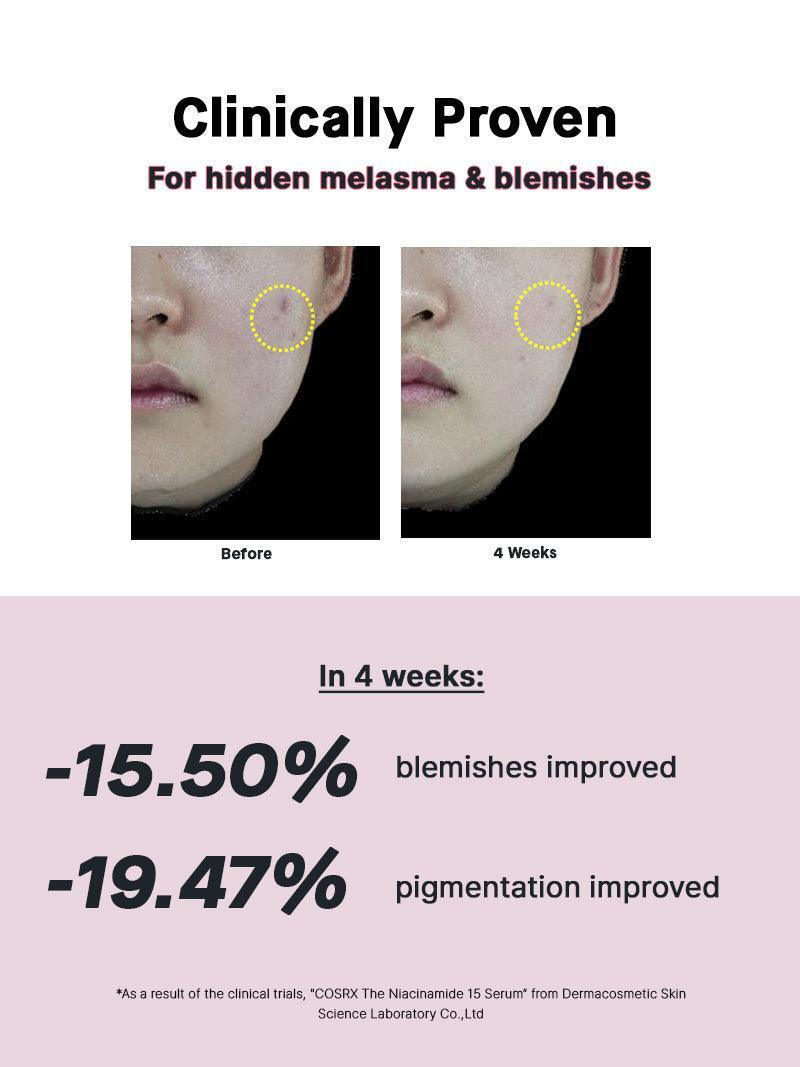 Cosrx The Niacinamide 15 Serum Προσώπου με Νιασιναμίδη για Λάμψη & Ακμή 20ml