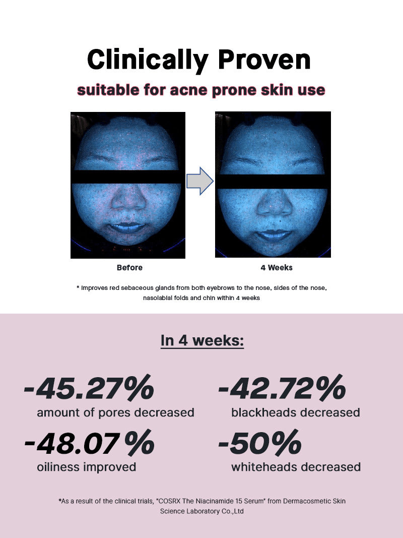 Cosrx The Niacinamide 15 Serum Προσώπου με Νιασιναμίδη για Λάμψη & Ακμή 20ml