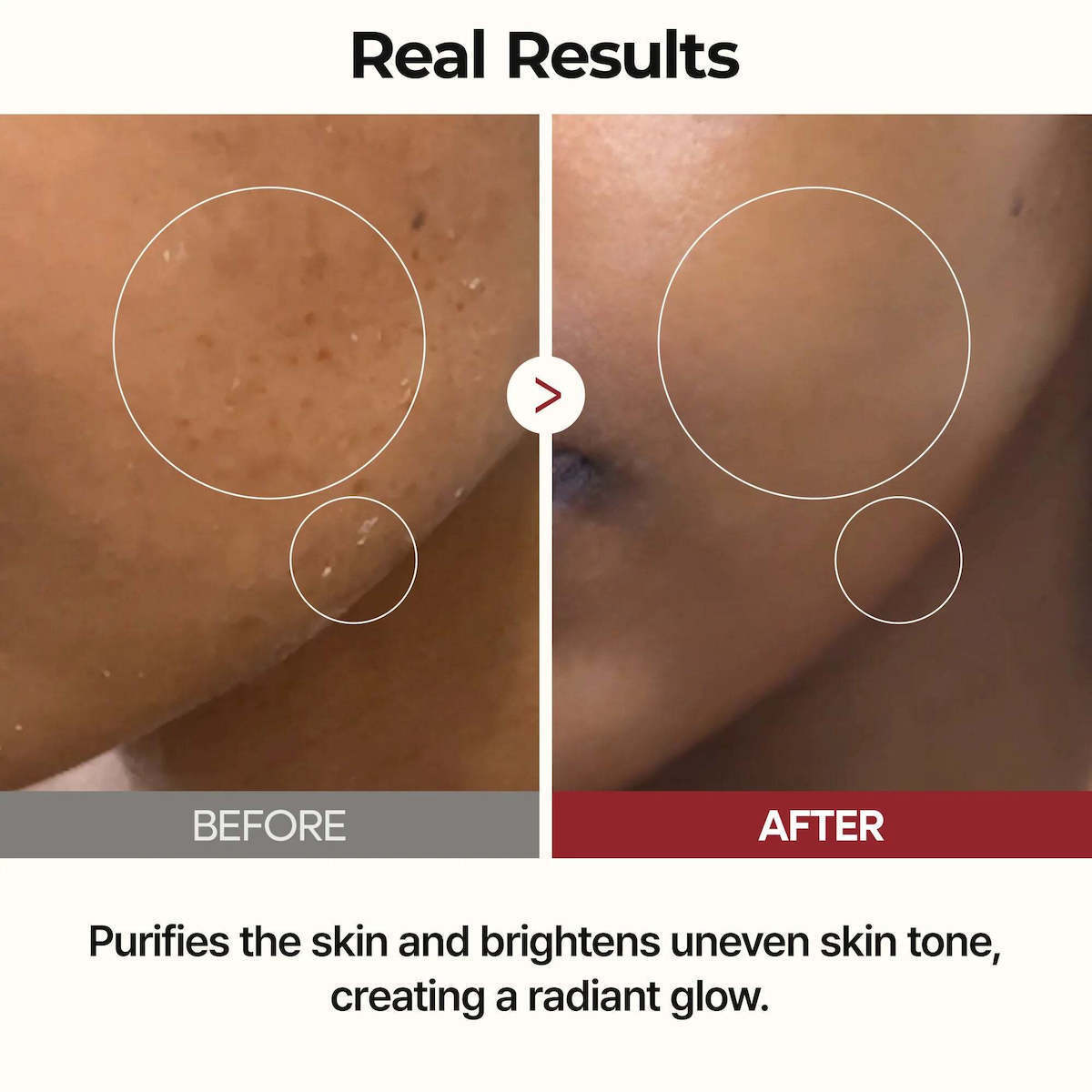 Dr. Melaxin Lotion Τόνωσης Προσώπου με Παράγωγα Ρυζιού 200ml