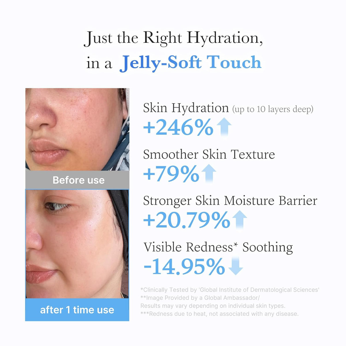 Hyaluronic Ceramide Jelly Cream – Ενυδατική Jelly Κρέμα για Λάμψη και Ενίσχυση του Επιδερμικού Φραγμού