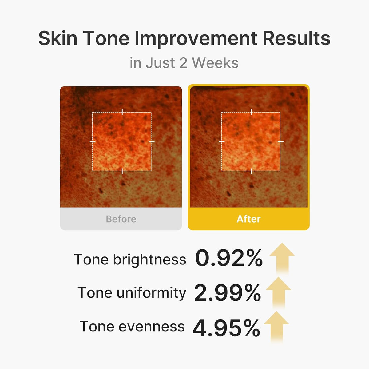 Kojic Acid Turmeric Vita Capsule Cream – Κρέμα Προσώπου με Kojic Acid, Κουρκουμά & Βιταμίνη C για Δυσχρωμίες και Λάμψη 53gr