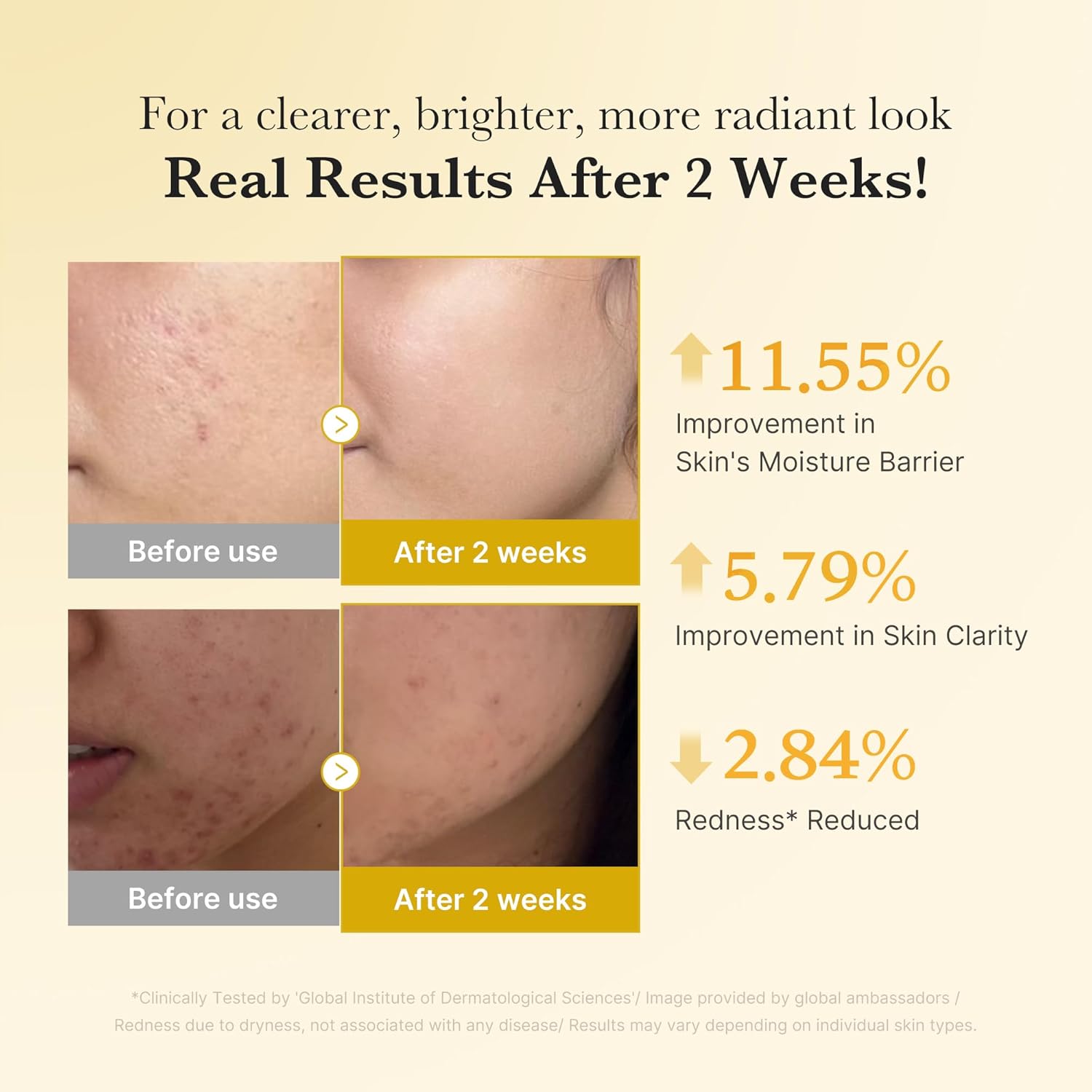 Medicube Kojic Acid Καταπραϋντικό & Ενυδατικό Serum Προσώπου με Νιασιναμίδη & Βιταμίνη E για Αποτοξίνωση & Λάμψη 30ml