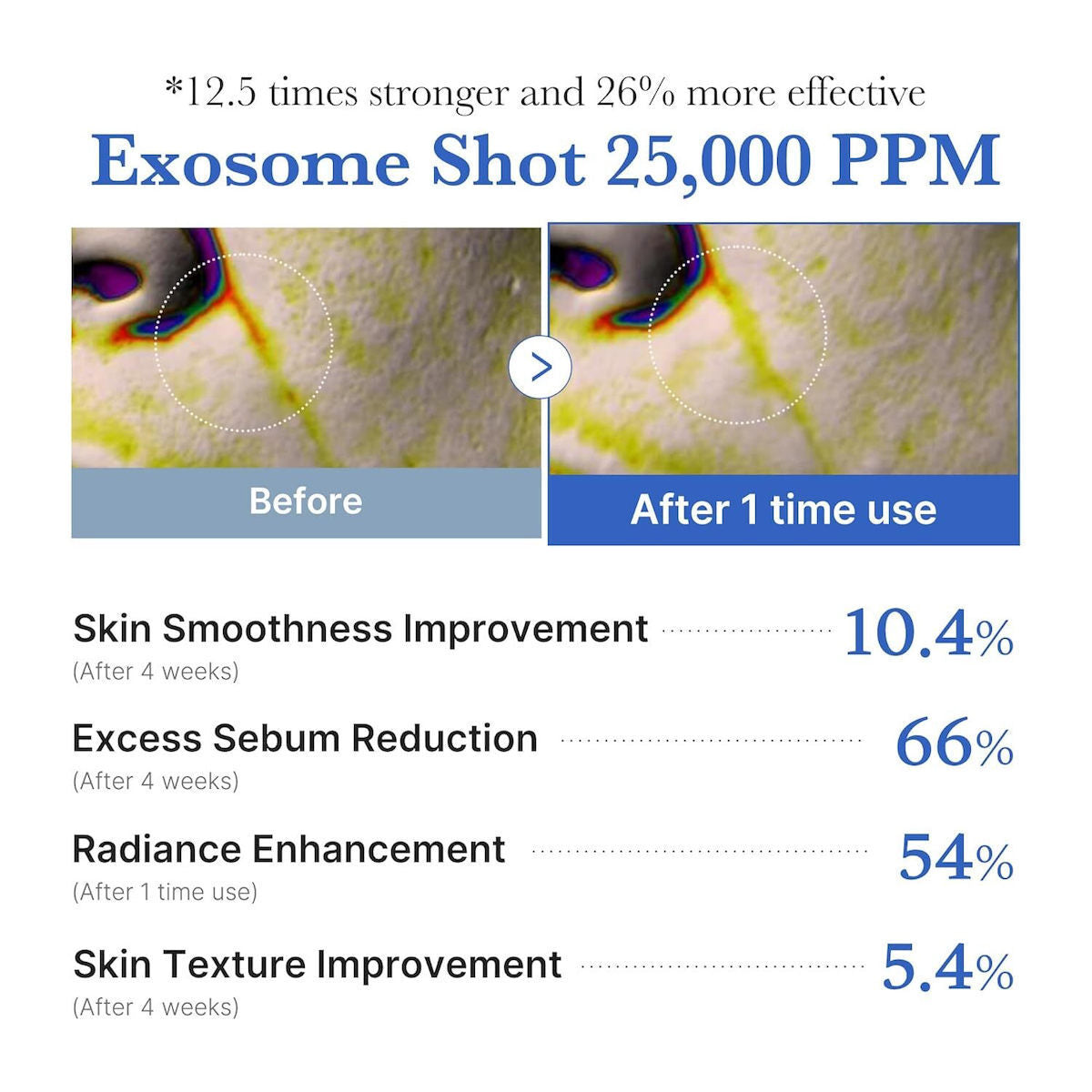 Medicube One Day Exosome Shot Pore 25000 Serum Προσώπου 13ml