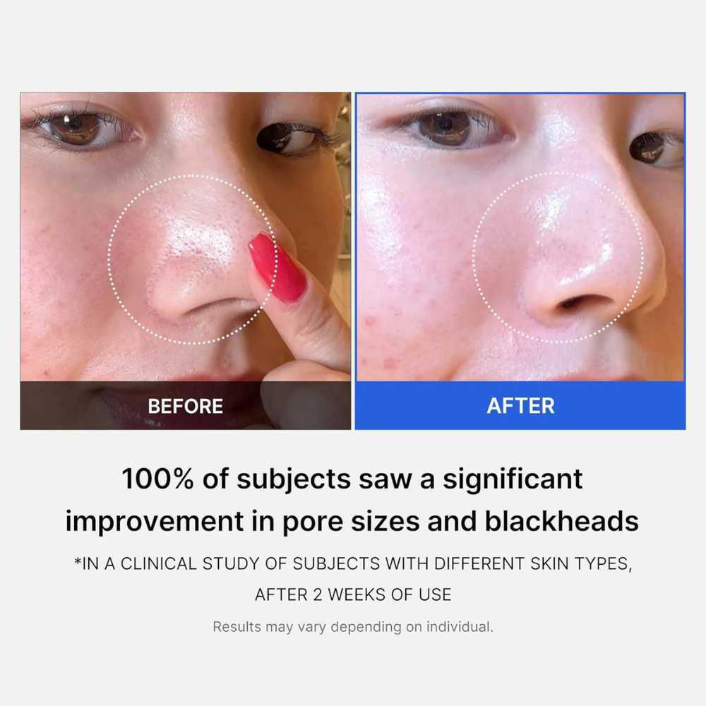 Medicube Zero Pore Pads Τόνωσης Προσώπου 70τμχ