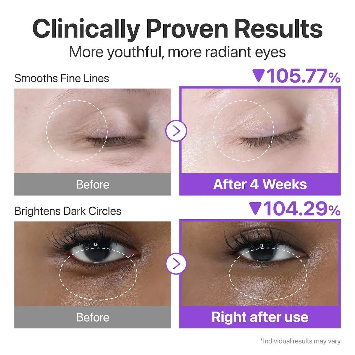 Numbuzin No.9 NAD Retinol Volumetox Κρέμα Ματιών για Αντιγήρανση & Σύσφιξη 10ml