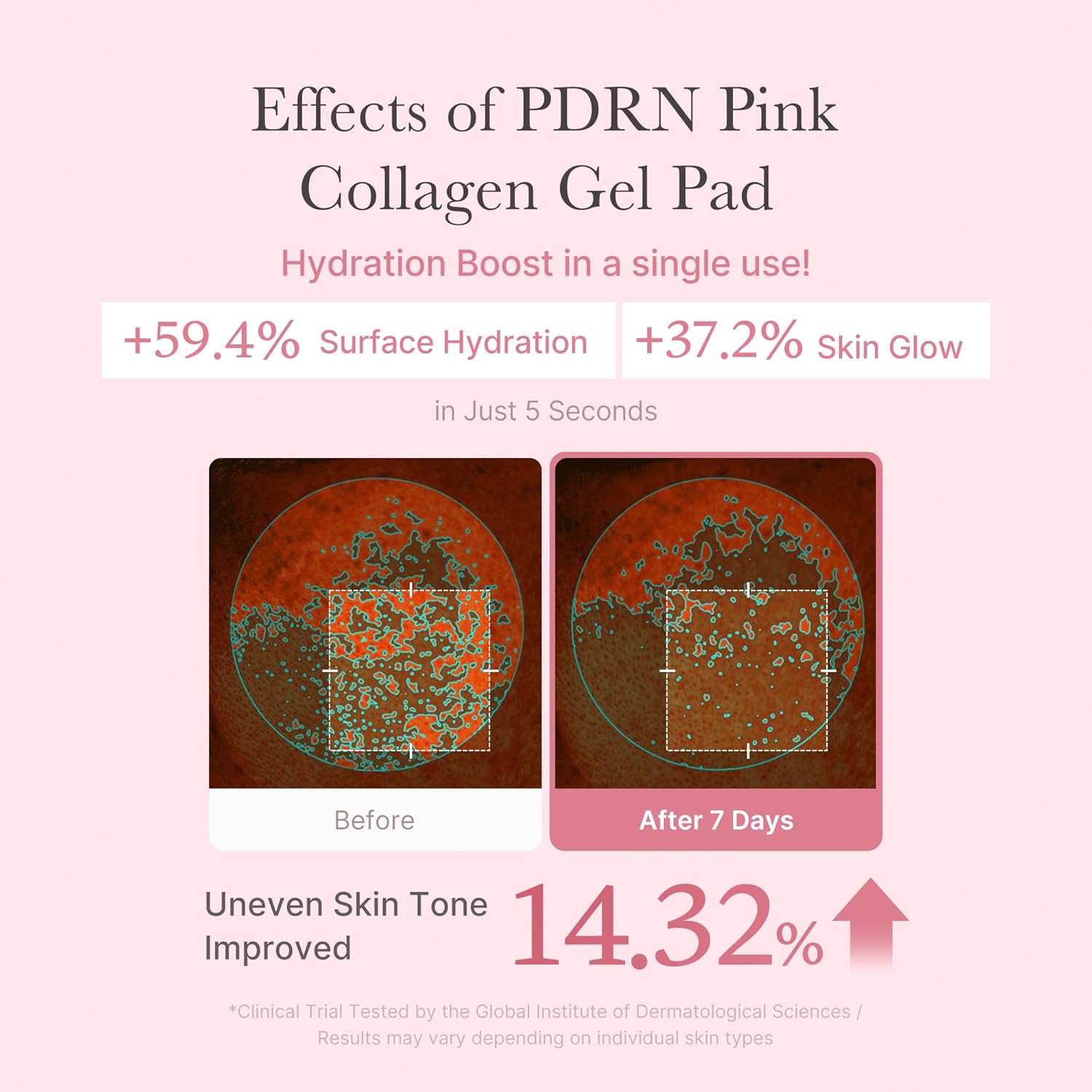 PDRN Pink Collagen Toning Gel Toner Pad - Επιθέματα εντατικής ενυδάτωση, σύσφιξης & λάμψης