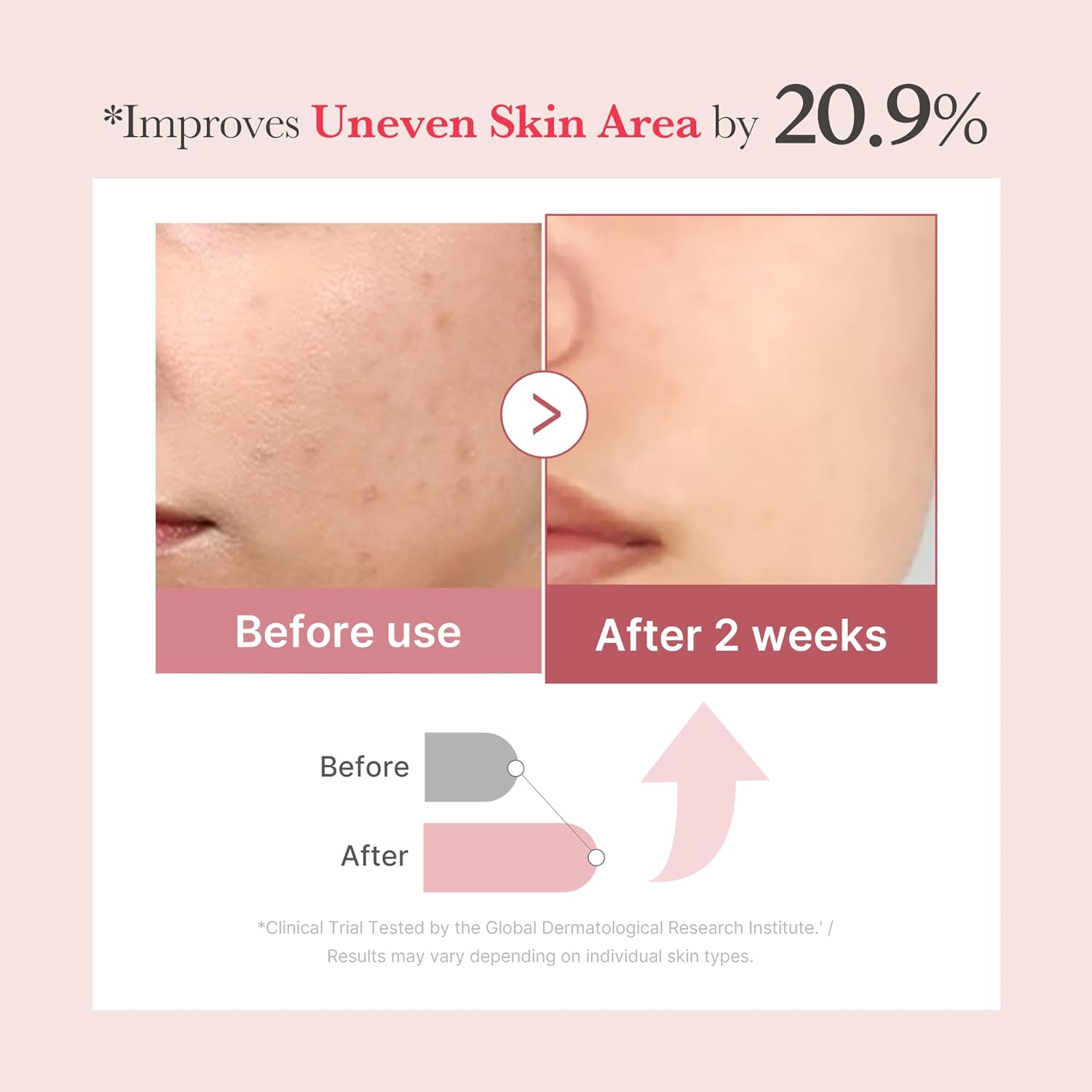 PDRN Pink Exosome Shot Serum 7500 - Ορός micro-needling για ατέλειες, δυσχρωμίες & ανομοιόμορφη υφή