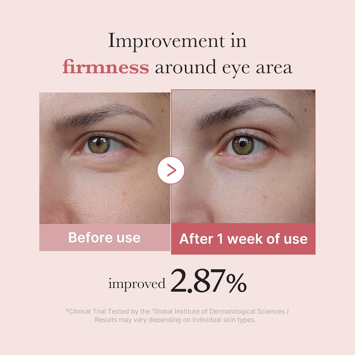 PDRN Pink Peptide Eye Cream - Κρέμα ματιών για ρυτίδες και μαύρους κύκλους 30ml