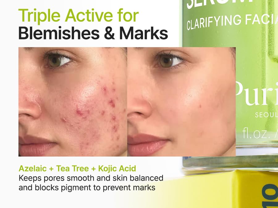 Purito Azelaic Acid 10 Kojic Tea Tree Serum Προσώπου για Λεύκανση & Ακμή 30ml