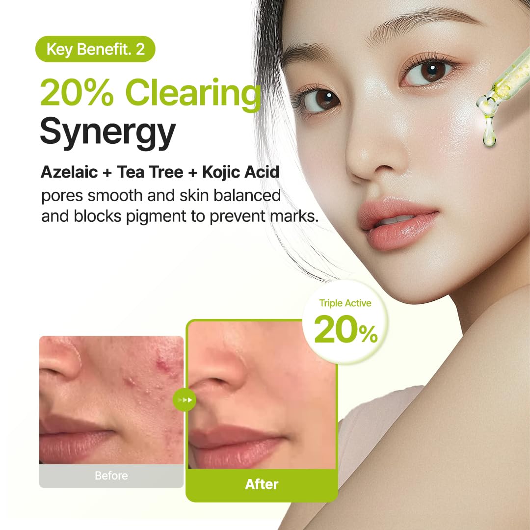 Purito Azelaic Acid 10 Kojic Tea Tree Serum Προσώπου για Λεύκανση & Ακμή 30ml