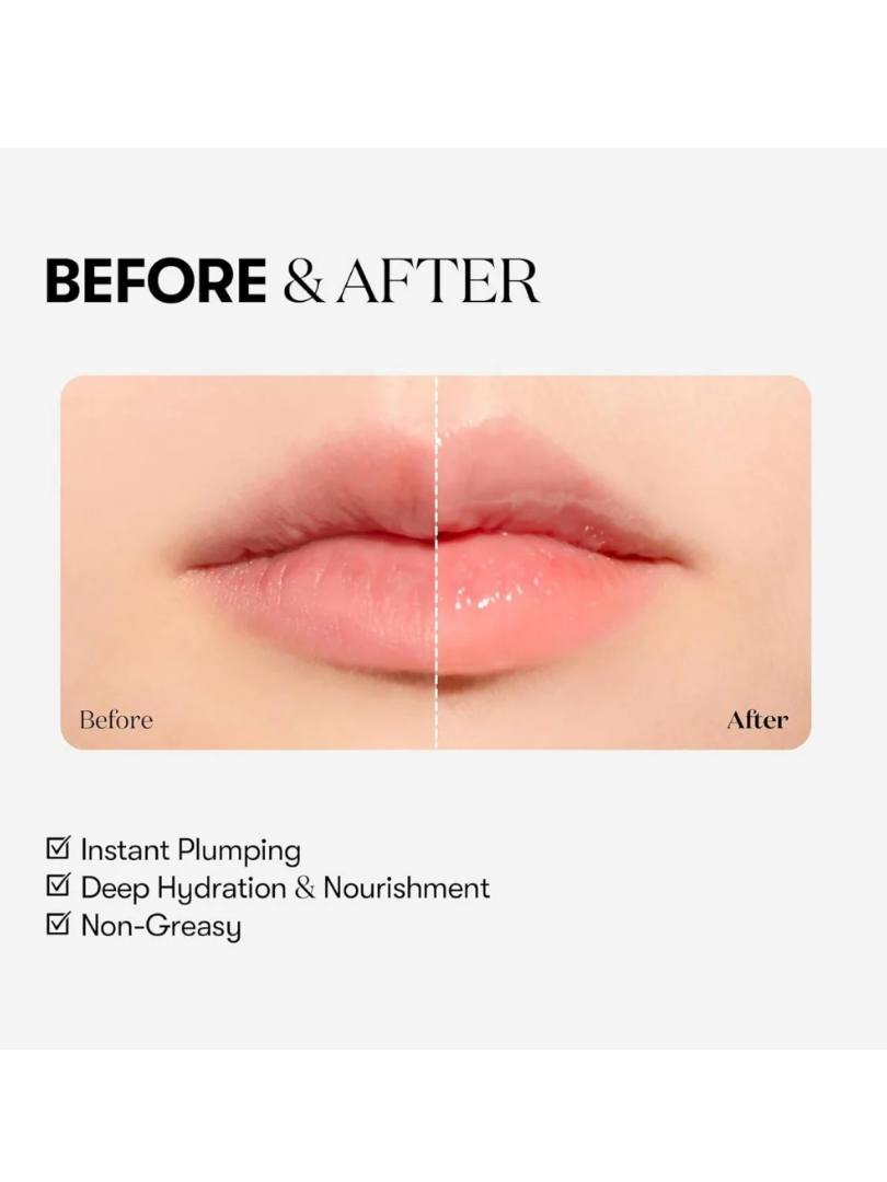 VT Reedle Shot Lip Plumper Beginner- Gloss με μικροβελόνες και εφέ όγκου