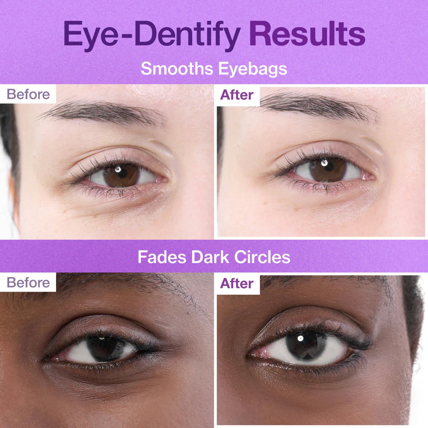 No.9 NAD Collagen Under Eye Patches - Eye Patches με Κολλαγόνο & 50 Πεπτίδια 1 ΤΜΧ
